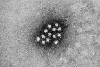 Imagen de un virus de la hepatitis tomada por un microscopio electrónico de barrido.