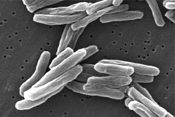 Los bacilos tuberculosos en el microscopio electrónico de barrido.